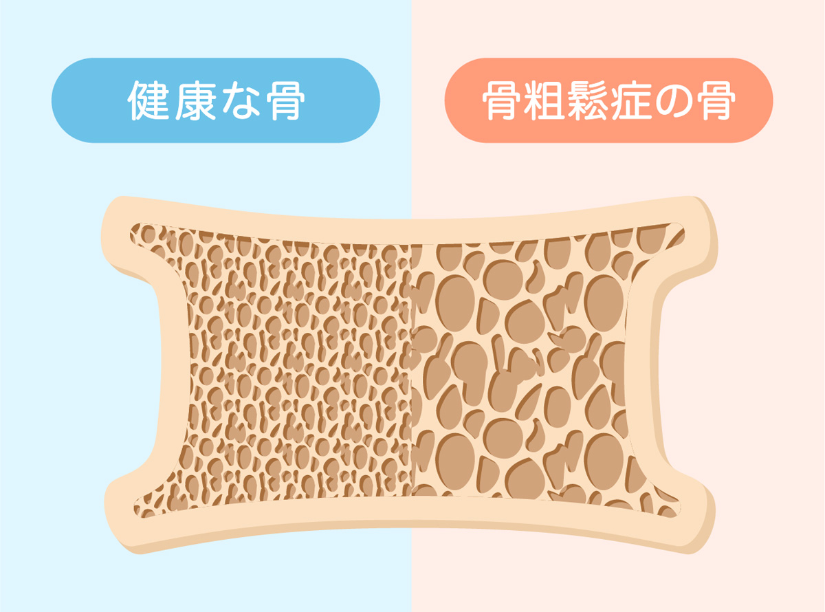 森医院 内科・生活習慣病・骨粗しょう症